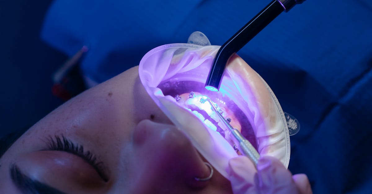 entdecken sie die ursachen, symptome und behandlungsmöglichkeiten von karies. erfahren sie, wie sie ihre zahngesundheit schützen und das risiko von karies reduzieren können. holen sie sich wertvolle tipps zur zahnpflege und zur frühzeitigen erkennung von karies.